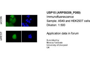 Immunofluorescence Sample Type: A549&HEK293T cellsPrimary Dilution: 1:500 (USP15 antibody  (C-Term))