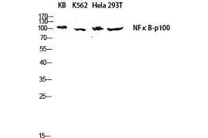 Western Blot (WB) analysis of KB K562 HeLa 293T lysis using NFkappaB-p100 antibody. (NFKB2 antibody  (Thr160))