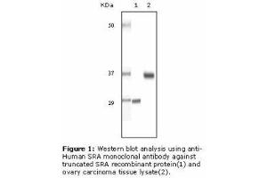 Image no. 2 for anti-Steroid Receptor RNA Activator 1 (SRA1) antibody (ABIN232100) (SRA1 antibody)