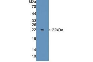 Figure. (IL1A antibody  (AA 115-270))