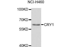 Western blot analysis of extracts of NCI-H460 cell lines, using CRY1 antibody. (CRY1 antibody)