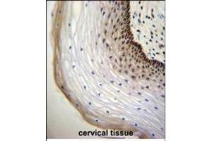 NU Antibody (Center) (ABIN655732 and ABIN2845179) immunohistochemistry analysis in formalin fixed and paraffin embedded human cervical tissue followed by peroxidase conjugation of the secondary antibody and DAB staining. (NUP107 antibody  (AA 398-425))