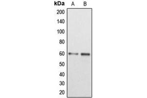 Western blot analysis of DAB1 expression in MCF7 (A), HEK293T (B) whole cell lysates. (DAB1 antibody  (Center))
