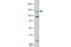 MAP4K4 monoclonal antibody (M07), clone 4A5 Western Blot analysis of MAP4K4 expression in K-562 . (MAP4K4 antibody  (AA 611-710))