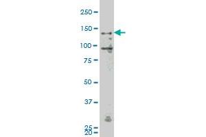 MAP4K4 monoclonal antibody (M07), clone 4A5 Western Blot analysis of MAP4K4 expression in K-562 .