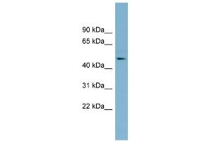 WB Suggested Anti-TMLHE Antibody Titration: 0. (TMLHE antibody  (Middle Region))