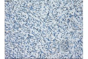 Immunohistochemical staining of paraffin-embedded colon tissue using anti-SORDmouse monoclonal antibody. (SORD antibody)
