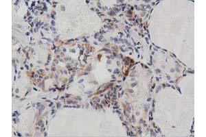 Immunohistochemical staining of paraffin-embedded Human liver tissue using anti-PECR mouse monoclonal antibody.
