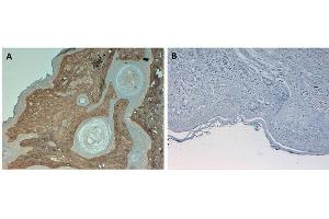 Immunohistochemistry of Rabbit Anti-Collagen Type I Antibody. (Collagen Type I antibody  (Biotin))