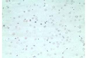 Image no. 1 for anti-rho GTPase Activating Protein 20 (ARHGAP20) (AA 570-620) antibody (ABIN207767) (ARHGAP20 antibody  (AA 570-620))