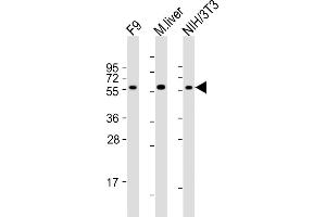 All lanes : Anti-Foxh1 Antibody (C-term) at 1:2000 dilution Lane 1: F9 whole cell lysates Lane 2: mouse liver lysates Lane 3: NIH/3T3 whole cell lysates Lysates/proteins at 20 μg per lane.