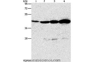 Western blot analysis of Mouse thymus tissue and A549 cell, Lovo and K562 cell, using APOBEC3D Polyclonal Antibody at dilution of 1:580