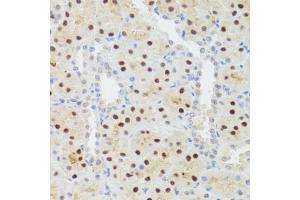 Immunohistochemistry of paraffin-embedded rat kidney using STAT4 antibody. (STAT4 antibody)