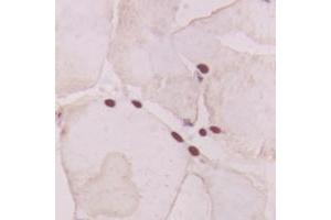 Immunohistochemical analysis of GNAT1 staining in human heart formalin fixed paraffin embedded tissue section. (GNAT1 antibody  (Center))