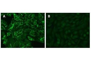 Immunofluorescence of stable CHO-K1/CEACAM1-transfectant with D14HD11. (CD66acde antibody)