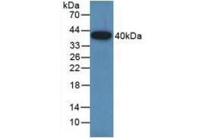 Detection of Recombinant GAP43, Rat using Polyclonal Antibody to Growth Associated Protein 43 (GAP43) (GAP43 antibody  (AA 8-226))
