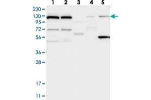 Western blot analysis of Lane 1: RT-4, Lane 2: U-251 MG, Lane 3: Human Plasma, Lane 4: Liver, Lane 5: Tonsil with DNAJC6 polyclonal antibody  at 1:250-1:500 dilution.