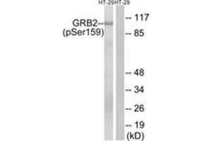 Western blot analysis of extracts from HT29 cells treated with serum 20% 15', using GRB2 (Phospho-Ser159) Antibody. (GRB2 antibody  (pSer159))