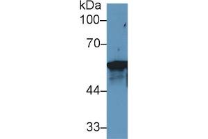 Western blot analysis of Human MCF7 cell lysate, using Rat KRT6A Antibody (1 µg/ml) and HRP-conjugated Goat Anti-Rabbit antibody ( (KRT6A antibody  (AA 323-461))