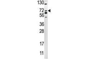 Image no. 1 for anti-SMAD Specific E3 Ubiquitin Protein Ligase 2 (SMURF2) (C-Term) antibody (ABIN357472) (SMURF2 antibody  (C-Term))