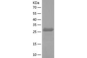 Western Blotting (WB) image for Small Nuclear Ribonucleoprotein Polypeptide A (SNRPA) (AA 1-255) protein (His tag) (ABIN7285211) (SNRPA1 Protein (AA 1-255) (His tag))