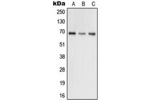Western blot analysis of GRK5 expression in H9C2 (A), HEK293T (B), HeLa (C) whole cell lysates. (GRK5 antibody  (Center))