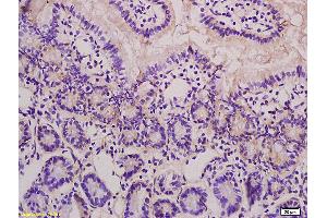 Formalin-fixed and paraffin embedded rat colon tissue labeled with Anti-BRRN1 Polyclonal Antibody, Unconjugated (ABIN873186) at 1:200, followed by conjugation to the secondary antibody and DAB staining. (NCAPH antibody  (AA 601-700))