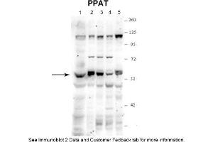 PPAT anticorps  (N-Term)