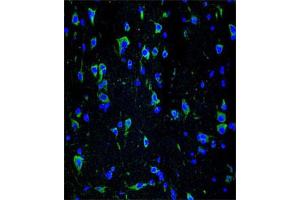 Immunofluorescent staining of brain tissue reacted with INA monoclonal antibody  at 1:10-1:50 dilution.