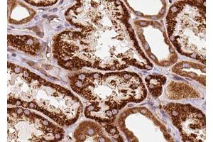 ABIN6272939 at 1/100 staining Human kidney tissue by IHC-P. (Centrin 1 antibody  (Internal Region))