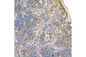 Immunohistochemistry of paraffin-embedded mouse spleen using [KO Validated] RA Rabbit pAb (ABIN3021646, ABIN3021647, ABIN3021648 and ABIN1513457) at dilution of 1:100 (40x lens). (RAB5 antibody  (AA 1-215))