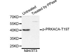 Western blot analysis of extracts of NIH/3T3 cells, using Phospho-PRKACA-T197 antibody. (PRKACA antibody)