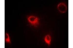 Immunofluorescent analysis of SFRP4 staining in Hela cells. (SFRP4 antibody)