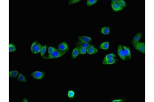 Immunofluorescent analysis of HepG2 cells using ABIN7161568 at dilution of 1:100 and Alexa Fluor 488-congugated AffiniPure Goat Anti-Rabbit IgG(H+L) (NNMT antibody  (AA 86-157))