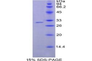 SDS-PAGE analysis of Human NNMT Protein.