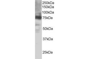 Western Blotting (WB) image for anti-Prostaglandin-Endoperoxide Synthase 2 (Prostaglandin G/H Synthase and Cyclooxygenase) (PTGS2) (C-Term) antibody (ABIN184672)