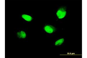 Immunofluorescence of monoclonal antibody to ZNF207 on HeLa cell. (ZNF207 antibody  (AA 1-110))