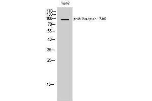 Western Blotting (WB) image for anti-Aryl Hydrocarbon Receptor (AHR) (pSer36) antibody (ABIN3182597) (Aryl Hydrocarbon Receptor antibody  (pSer36))