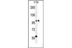 Western blot analysis of PHF20 Antibody (N-term) in Y79 cell line lysates (35ug/lane). (PHF20 antibody  (N-Term))