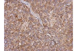 IHC-P Image Immunohistochemical analysis of paraffin-embedded Huh7 xenograft, using APOL1, antibody at 1:500 dilution. (APOL1 antibody)