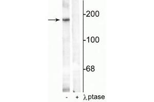 Western blot of rat hippocampal lysate showing specific immunolabeling of the ~180 kDa NR2B subunit phosphorylated at Tyr1336 in the first lane (-). (GRIN2B antibody  (pTyr1336))