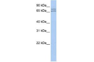 WB Suggested Anti-DDX27 Antibody Titration:  0. (DDX27 antibody  (N-Term))