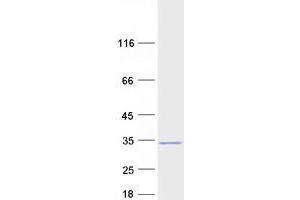 Western Blotting (WB) image for Ubiquitin-Conjugating Enzyme E2R 2 (UBE2R2) protein (Myc-DYKDDDDK Tag) (ABIN2734864)