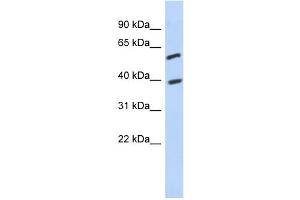 WB Suggested Anti-C6orf146 Antibody Titration: 0. (FAM217A antibody  (Middle Region))