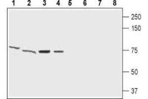 Western blot analysis of rat brain membrane (lanes 1 and 5), mouse brain lysate (lanes 2 and 6), human   neuroblastoma cells lysate (lanes 3 and 7) and human U87 MG  glioblastoma cells lysate (lanes 4 and 8):1-4.