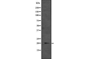 Western blot analysis of CENPM expression in K-562 cell lysate at 25ug/lane,The lane on the left is treated with the antigen-specific peptide. (CENPM antibody  (Internal Region))