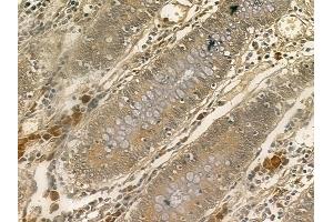 RPC6 Mouse Monoclonal Antibody at 1/100 staining human normal colon tissue by IHC-P.