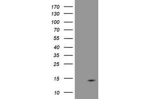 Image no. 4 for anti-D-Dopachrome Tautomerase (DDT) antibody (ABIN1497798) (DDT antibody)