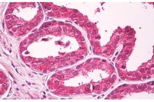 Anti-CXADR antibody IHC staining of human prostate. (Coxsackie Adenovirus Receptor antibody)