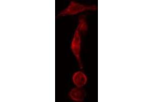 ABIN6275567 staining  Hela cells by IF/ICC. (SH3GLB2 antibody  (C-Term))